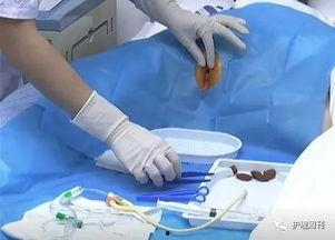 尿道视频,视频解析人体排泄系统的奥秘